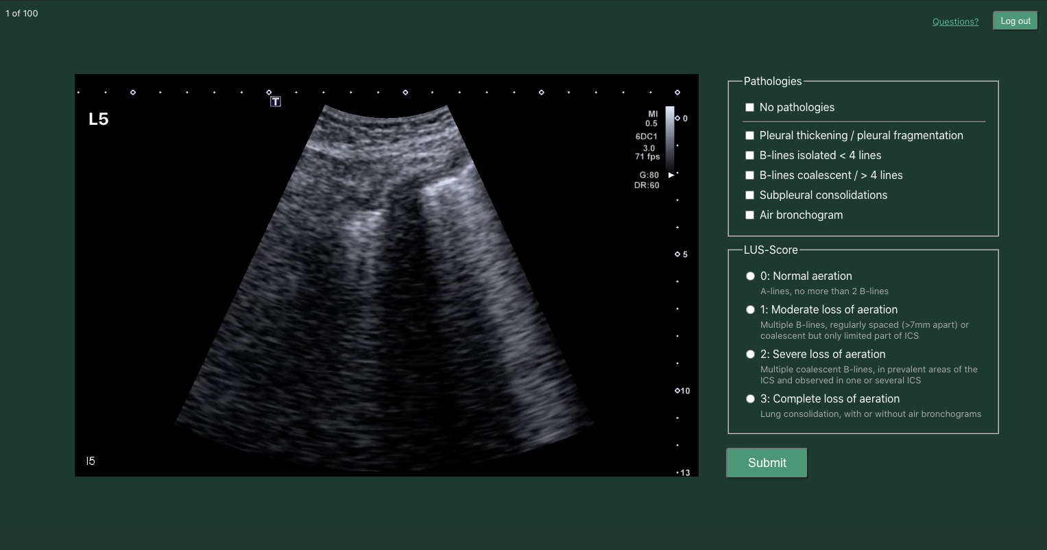 Charité lung ultrasound study preview